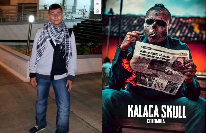 Ölmüş anasının skeletinə bənzəmək üçün burnunu və qulağını kəsdi - Fotolar