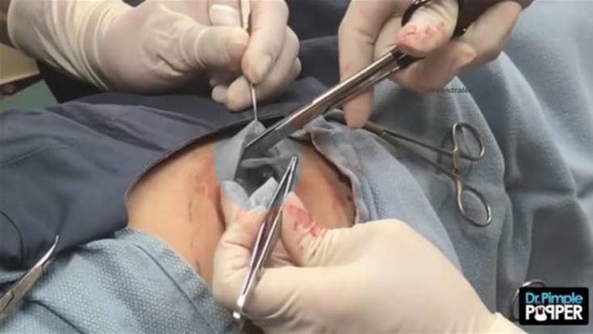 Ombasındakı şişə görə həkimə getdi - Çıxanlara İNANMADILAR - FOTOLAR