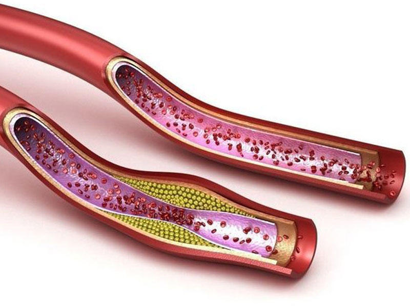 Damarları təmizləyən, ürəyi qoruyan yağlı məhsul - hər gün yeyin!