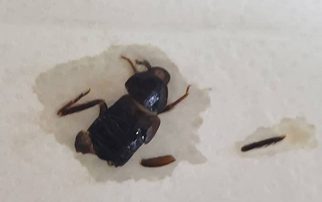 Bakıda qadının uşaqlıq yolundan bu həşarat çıxdı - Foto