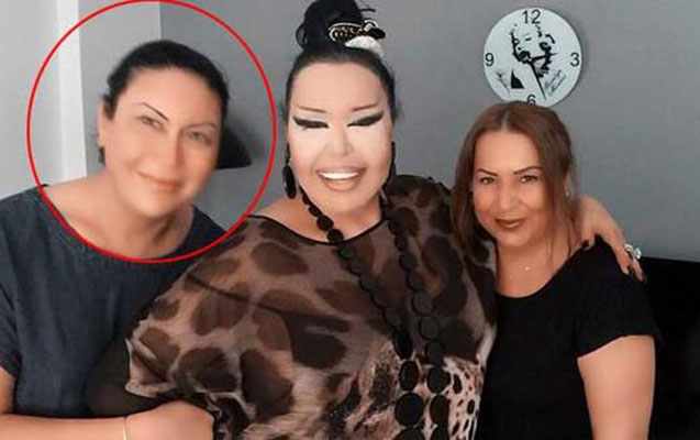 Bülənt Ərsoya bənzəmək üçün 10 əməliyyat keçirdi - Fotolar