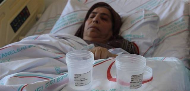 66 il öncə udmuşdu- Həkimlər görəndə heyrətə düşdü - FOTO