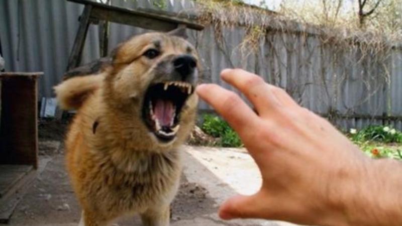 Şəkidə 6 yaşlı qızın üzünü sahibsiz it dişlədi