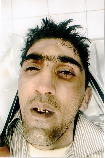 Bulvarda intihar edən şəxsin DƏHŞƏTLİ FOTOSU YAYILDI