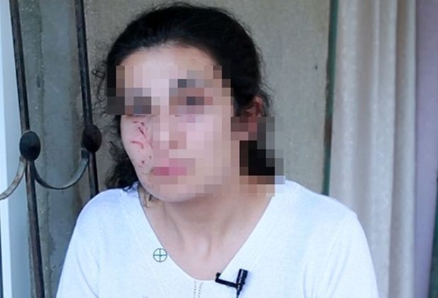 Bakıda zorlanmadan son anda qurtarılan qadın danışdı - VİDEO