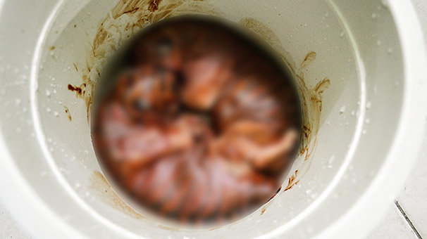 Dəhşətə gətirən görüntülər - Qarnından çıxanlar görənləri şok etdi - FOTOLAR