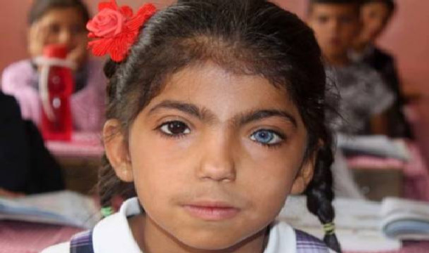 Gözlərini görən çaşqınlıq yaşayır – Fotolar