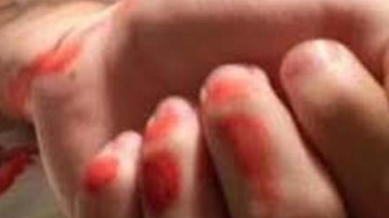 Bakıda məcburi köçkünün tikdiklərini sökdülər – QADIN DAMARLARINI DOĞRADI