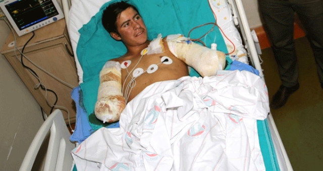 17 yaşlı gənc quşu xilas etmək istəyərkən qollarından oldu - FOTO