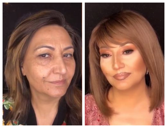 Əməkdar artisti görənlər ŞOKDA - elə dəyişildi ki... -VİDEO