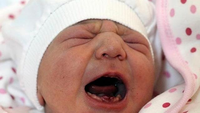 Yeni doğulan körpə hər kəsi şoka saldı: Ağzında 9 dişi var - FOTO