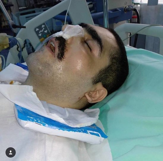 Aprel döyüşlərinin qəhrəmanı komadadır: Vəziyyəti ağırdır - FOTO