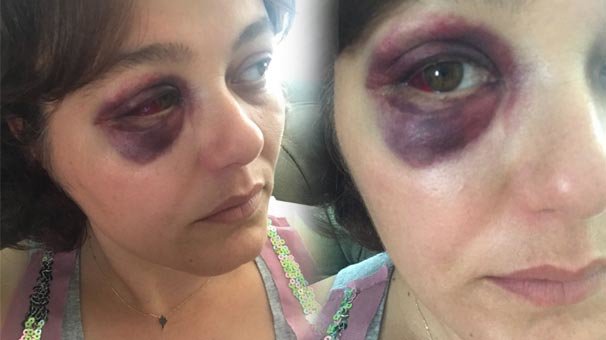 Restorandakı qadına 