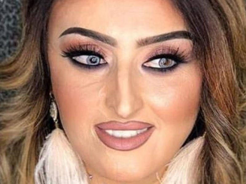 Azərbaycanda üzü tamamilə yanan qızın İNANILMAZ DƏYİŞİMİ