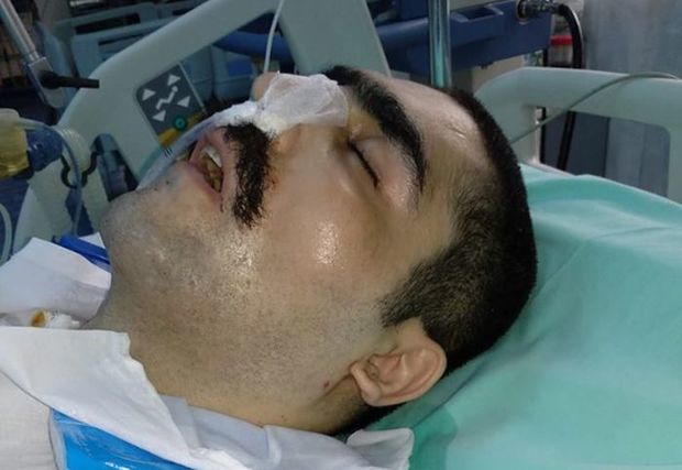 Qoşqar Hacıyevin vəziyyəti kəskin pisləşib