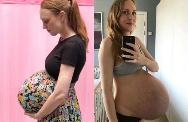 Qarnını görənlər inana bilmirlər - FOTOLAR