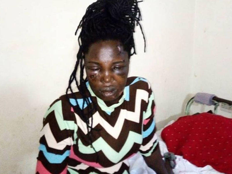 Qadın fahişə yanına gedən sevgilisini kişilikdən məhrum etdi - FOTO