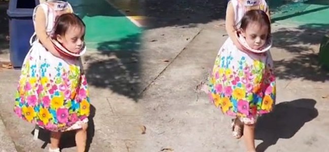 Başını əlində gəzdirən qız görənləri şok etdi - VİDEO