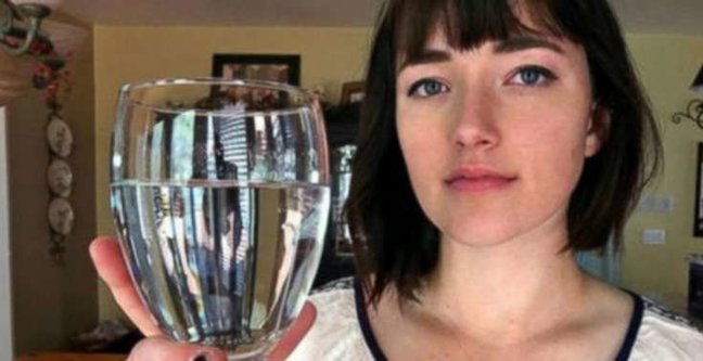 17 yaşlı qız yer üzündəki ən dəhşətli xəstəliklə mübarizə aparır - FOTO