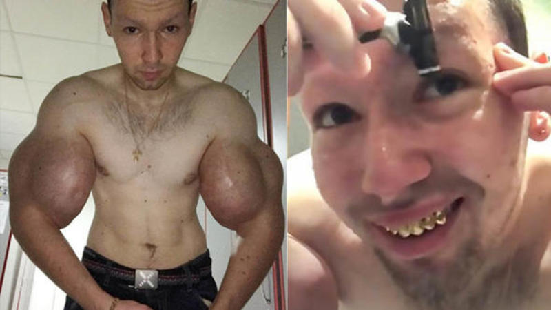 Qadınları ovsunlamaq üçün inanılmaz yola əl atdı - ŞOK GÖRÜNTÜLƏR