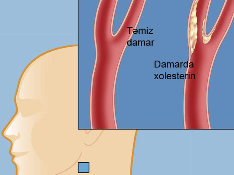 Xolesterinin və yüksək təzyiqin birinci düşməni - hər gün 1 ovuc yeyin!