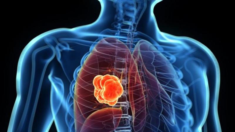 Azərbaycanda ŞOK HADİSƏ: 5 yaşından yanlış diaqnozla müalicə aldı, 21 il sonra...