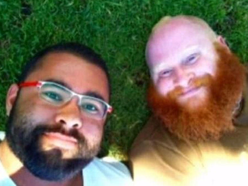 Genital bölgəsinə silikon qoyduran kişi öldü - FOTO