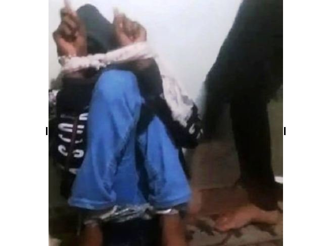 Həyat yoldaşı ilə intim münasibətdə olan kişiyə ağlasığmaz işgəncə verdi - FOTOLAR