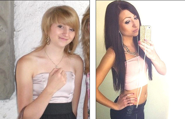 Xarici görünüşünə görə ələ salınan gənc qız estetik əməliyyatlardan sonra tanınmaz halda - FOTOLAR