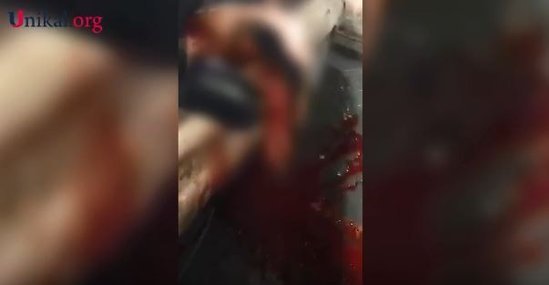 Bakıdakı dəhşətli qəzanın görüntüləri yayıldı - Qadının başı parçalandı (VİDEO)