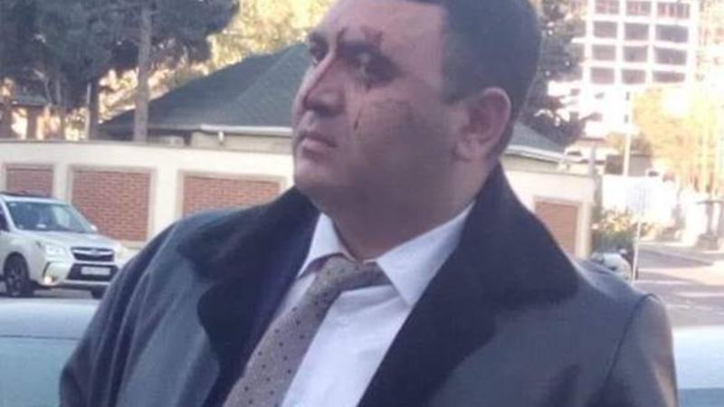 Bakı Şəhər Təhsil İdarəsindən döyülən direktorla bağlı AÇIQLAMA