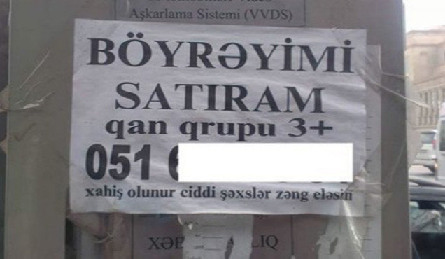 Azərbaycanda orqanlarını satışa çıxaranlara icazə var? – Video