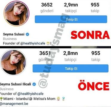 Acundan boşanandan sonra ilk işi bu oldu - FOTO