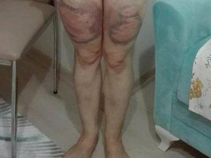 Arvadının başqa kişi ilə mesajlaşdığını gördü - Keç otağa, soyun - FOTO