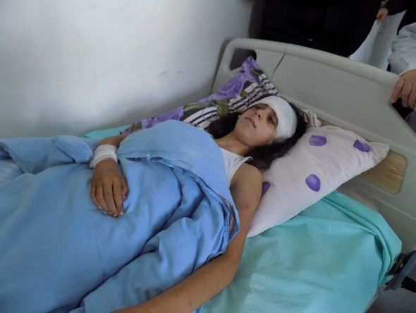 Daha bir canavar hücumu: Bu dəfə Astarada - FOTO