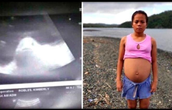 17 yaşlı qızın qarnından çıxan hamını şoka saldı - Fotolar