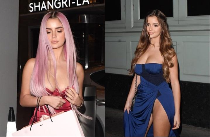 25 yaşlı model imicini dəyişdi - Fotolar