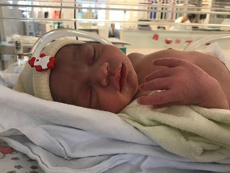 Dünyada ilk dəfə: ölmüş qadın dünyaya uşaq 