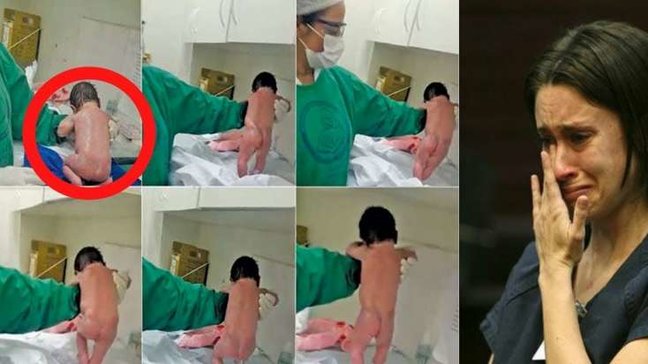 ​Yeni doğulan körpə bu hərəkəti ilə anasını ağlatdı - Həkimlər ŞOKA DÜŞDÜ - VİDEO