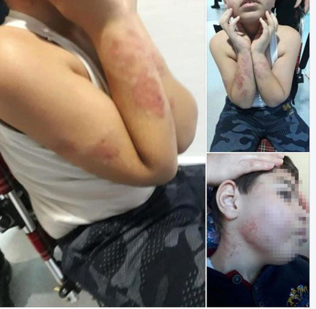 Özəl Mərkəzdə VƏHŞİLİK: Əlil uşağı döyüb bu hala saldılar - FOTOLAR