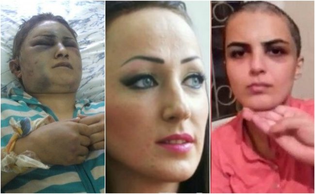 Başqa kişi ilə tutduğu arvadının əl qolunu bağlayıb qulağını kəsdi, başını qırxdı - Azərbaycanda ŞOK