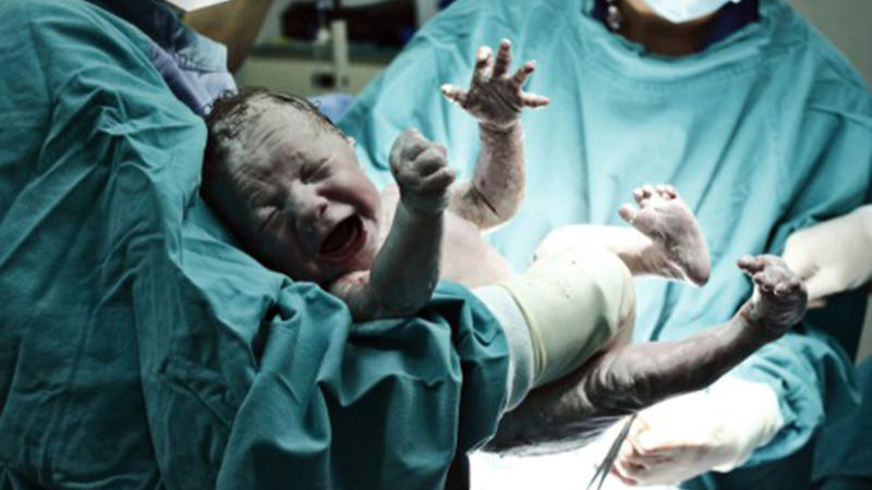 Azərbaycanda 18 yaşlı anadan QANDONDURAN ƏMƏL: doğulacaq körpəsinin xəstə olduğunu bildi və...