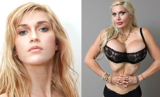 200-dən çox plastik əməliyyat keçirən qadının son istəyi həkimləri şoka saldı — FOTOLAR