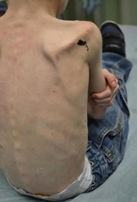 Ögey atası və qardaşı 5 yaşlı uşağa zülm etdi: Dolaba salıb günlərlə ac saxladılar və... - FOTOLAR