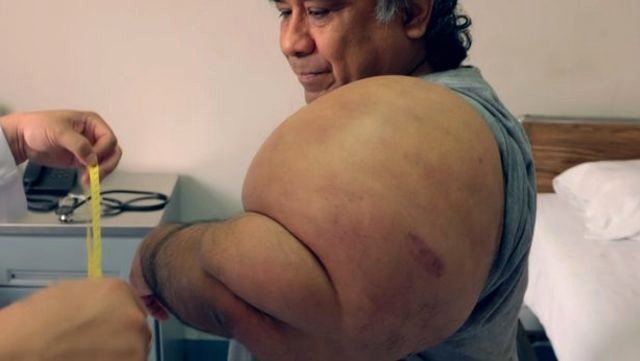 Bədəni birdən şişməyə başladı, səbəbini biləndə həyatının şokunu yaşadı - FOTOLAR