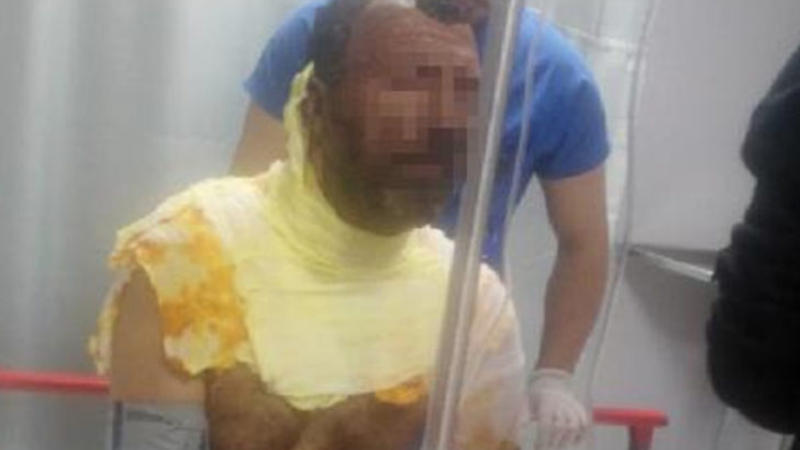 Kişi özünü yandırdı: Arvadımla... – Səbəbi sizi ŞOKA SALACAQ