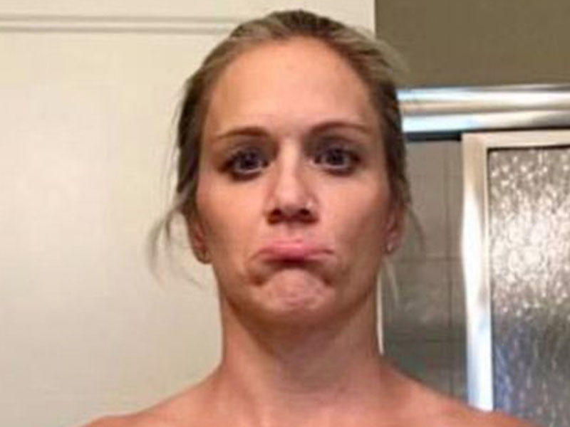 4 il əvvəl əməliyyata girən qadının sinəsi bu hala düşdü - FOTO