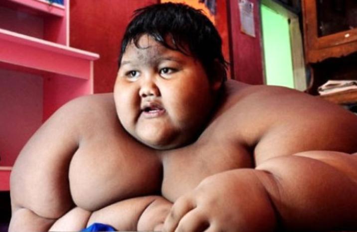 Dünyanın ən gombul uşağı 100 kiloqram arıqladı - Fotolar