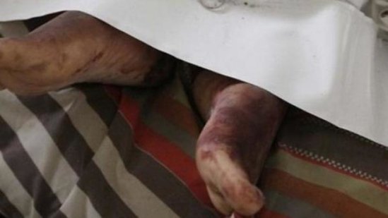 Azərbaycanda dəhşətli HADİSƏ: vəhşi heyvanlar evə soxulub KİŞİNİ PARÇA-PARÇA ETDİ