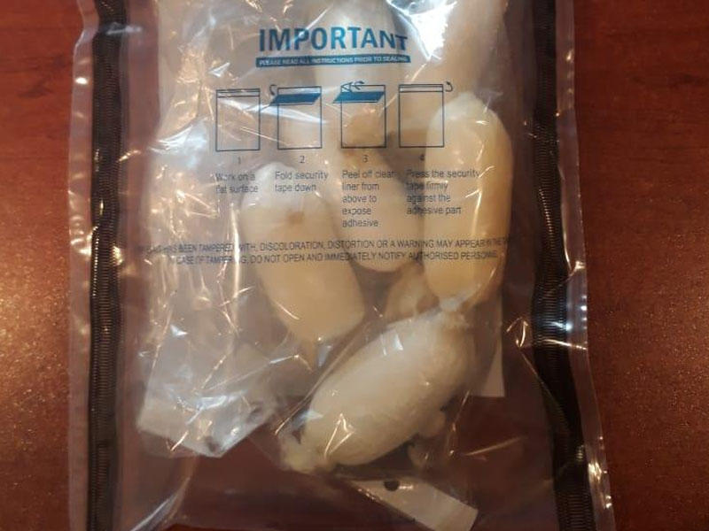 İran vətəndaşı Azərbaycana düz bağırsağında narkotik keçirmək istədi